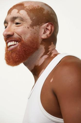 AKIN-CAVALCANTE-By-CARLOS-SALES-1